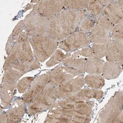 Immunohistochemistry-Paraffin: KBTBD4 Antibody [NBP2-38363]