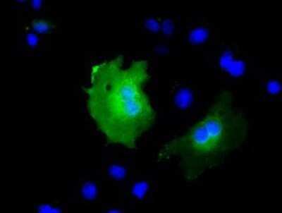 Immunocytochemistry/ Immunofluorescence: KBTBD7 Antibody (OTI1G3) - Azide and BSA Free [NBP2-72268]