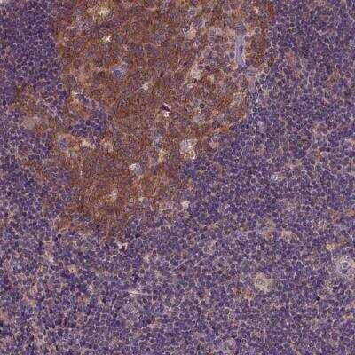 Immunohistochemistry: KBTBD8 Antibody [NBP2-56273]