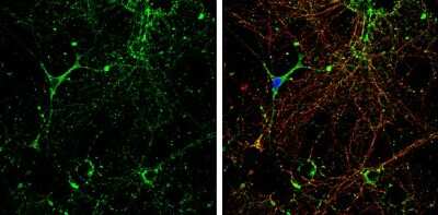 Immunocytochemistry/ Immunofluorescence: KCC2/SLC12A5 Antibody [NBP3-13161]