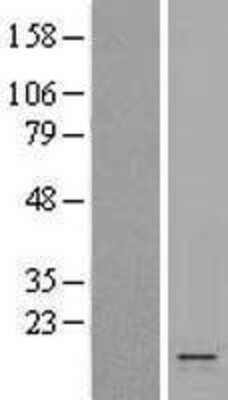 Western Blot: KCNE1 Overexpression Lysate [NBP2-09459]