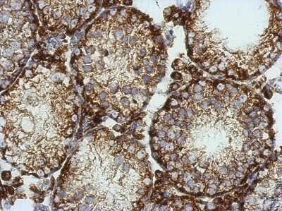 Immunohistochemistry-Paraffin: Kv6.4 Antibody [NBP2-17028]
