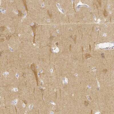 Immunohistochemistry-Paraffin: KCNH1 Antibody [NBP1-84935]