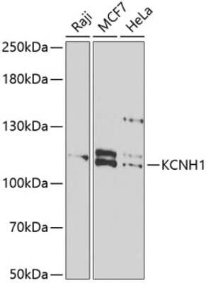 Western Blot: KCNH1 AntibodyBSA Free [NBP3-05164]