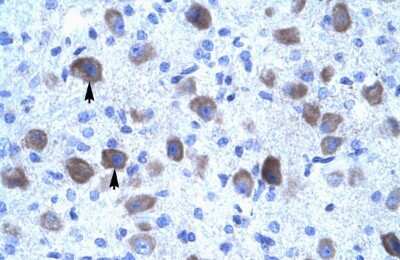 Immunohistochemistry: KCNIP4 Antibody [NBP2-84105]