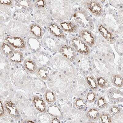 Immunohistochemistry-Paraffin: KCNJ1 Antibody [NBP1-82874]