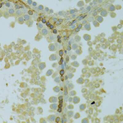 Immunohistochemistry-Paraffin: KCNJ1 Antibody - BSA Free [NBP3-04802]