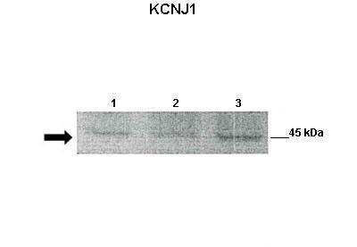 Western Blot: KCNJ1 Antibody [NBP2-87660]