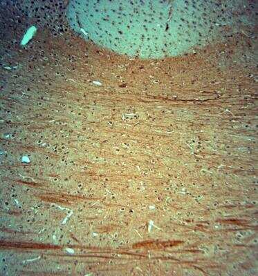 Immunohistochemistry-Paraffin: KCNJ10 Antibody [NBP1-20149]