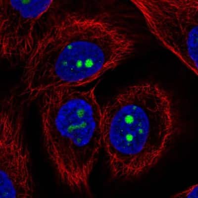 Immunocytochemistry/ Immunofluorescence: KCNJ14 Antibody [NBP2-57775]