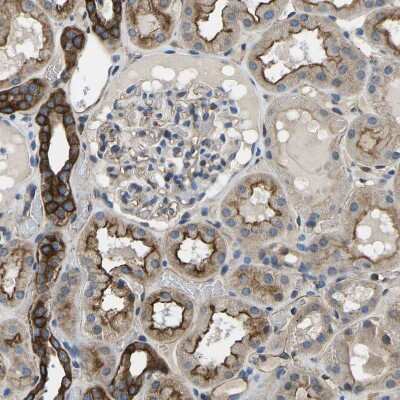 Immunohistochemistry-Paraffin: KCNJ15 Antibody [NBP1-83091]