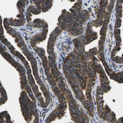 Immunohistochemistry-Paraffin: KCNJ15 Antibody [NBP1-83091]