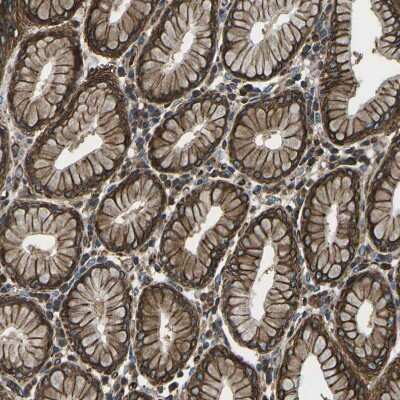 Immunohistochemistry-Paraffin: KCNJ15 Antibody [NBP1-83091]