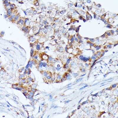 Immunohistochemistry-Paraffin: KCNJ15 Antibody - Azide and BSA Free [NBP3-04863]