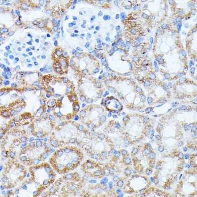 Immunohistochemistry-Paraffin: KCNJ15 Antibody - Azide and BSA Free [NBP3-04863]