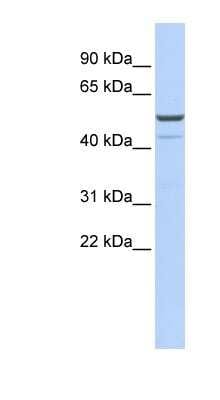 Western Blot: KCNK12 Antibody [NBP1-80084]