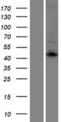 Western Blot: KCNK12 Overexpression Lysate [NBP2-06479]