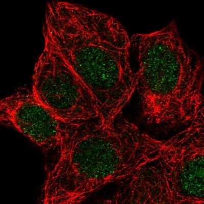 Immunocytochemistry/ Immunofluorescence: KCNK5 Antibody [NBP2-32432]