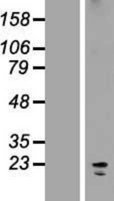 Western Blot: KCNK7 Overexpression Lysate [NBP2-05875]
