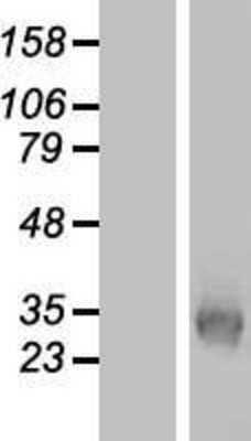 Western Blot: KCNK7 Overexpression Lysate [NBP2-05886]