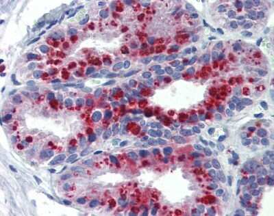 Immunohistochemistry: KCNK9 Antibody [NBP2-84109]