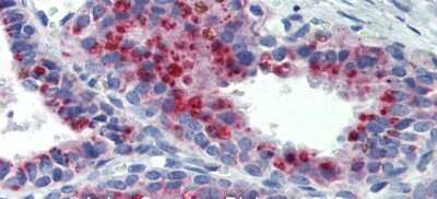 Immunohistochemistry: KCNK9 Antibody [NBP2-84109]