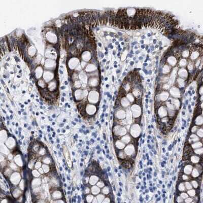 Immunohistochemistry-Paraffin: KCNMB3 Antibody [NBP1-83065]