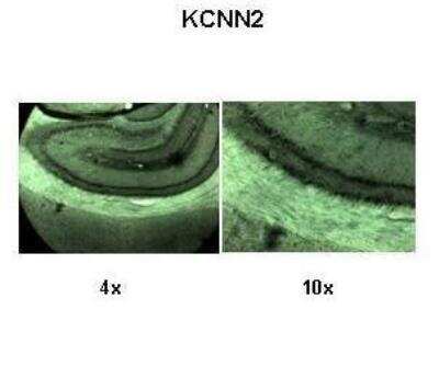 Immunohistochemistry: KCNN2 Antibody [NBP2-84111]