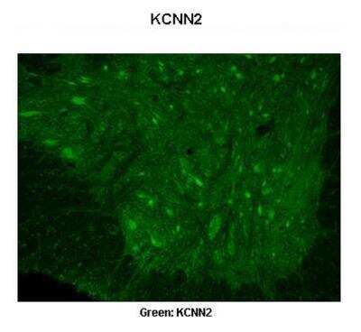 Immunohistochemistry: KCNN2 Antibody [NBP2-84111]