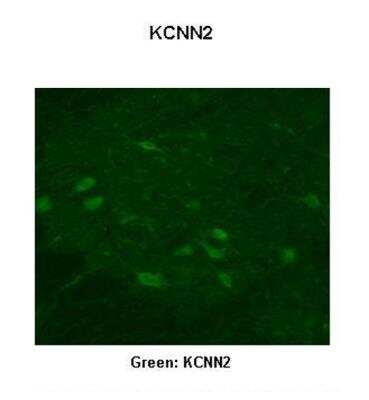 Immunohistochemistry: KCNN2 Antibody [NBP2-84112]
