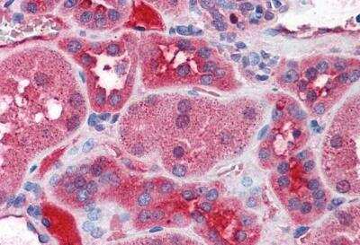 Immunohistochemistry-Paraffin: KCNN2 Antibody [NBP1-46119]