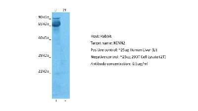 Western Blot: KCNN2 Antibody [NBP2-84111]