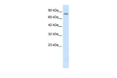 Western Blot: KCNN3 Antibody [NBP2-85137]