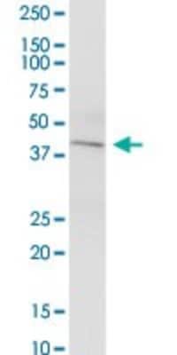 Western Blot: KCNN4 Antibody [H00003783-B01P]