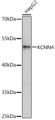 Western Blot: KCNN4 AntibodyAzide and BSA Free [NBP3-04926]