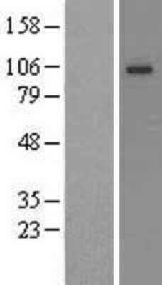 Western Blot: Kv7.3 Overexpression Lysate [NBL1-12199]