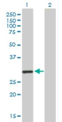 Western Blot: KCNRG Antibody [H00283518-B01P]