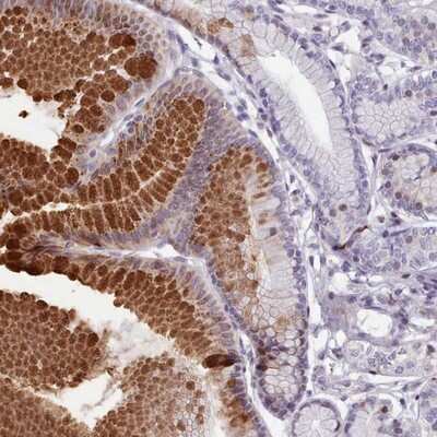 Immunohistochemistry-Paraffin: KCNT2 Antibody [NBP2-14146]
