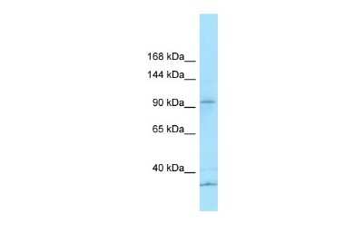 Western Blot: KCP Antibody [NBP1-98275]