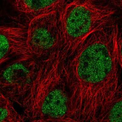 Immunocytochemistry/ Immunofluorescence: KCTD11 Antibody [NBP2-47412]