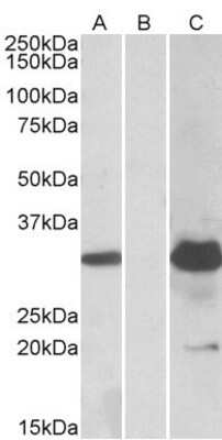 Western Blot: KCTD11 Antibody [NBP1-72049]