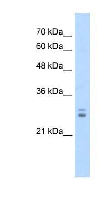Western Blot: KCTD11 Antibody [NBP1-80109]