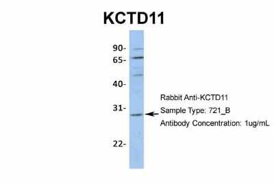 Western Blot: KCTD11 Antibody [NBP1-80211]