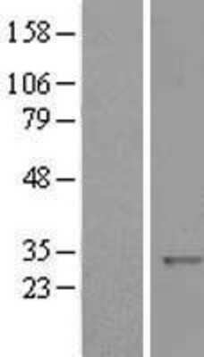 Western Blot: KCTD11 Overexpression Lysate [NBL1-12208]