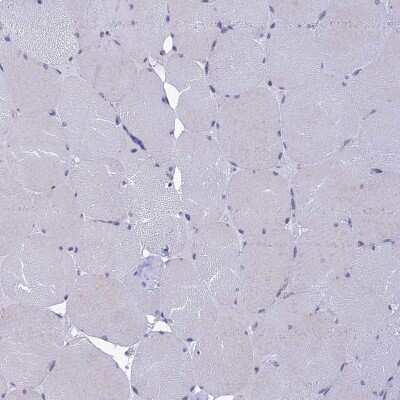 Immunohistochemistry-Paraffin: KCTD14 Antibody [NBP1-92042]