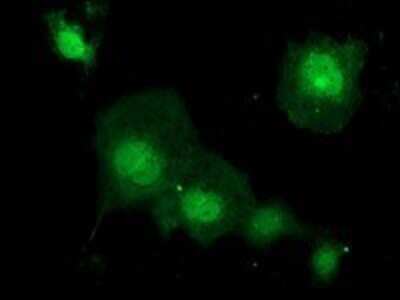 Immunocytochemistry/ Immunofluorescence: KCTD14 Antibody (OTI1D11) - Azide and BSA Free [NBP2-72173]
