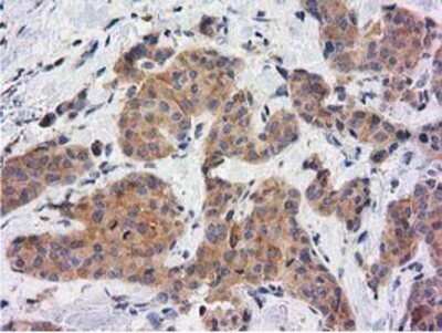 Immunohistochemistry: KCTD14 Antibody (OTI1D11) - Azide and BSA Free [NBP2-72173]