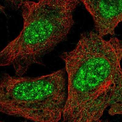 Immunocytochemistry/ Immunofluorescence: KCTD16 Antibody [NBP2-30652]