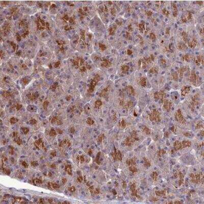 Immunohistochemistry: KCTD16 Antibody [NBP2-30470]