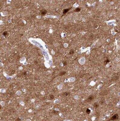 Immunohistochemistry-Paraffin: KCTD16 Antibody [NBP2-30652]